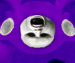 Tinky Winky (Infected)
