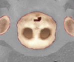 The Guardian (Corpse)